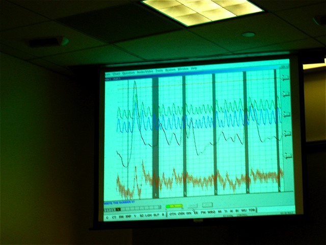 The output of a polygraph exam in progress.